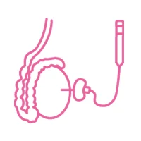 Sperm Retrieval